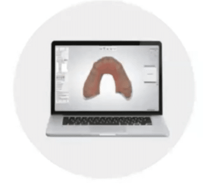 Plan de traitement 3D