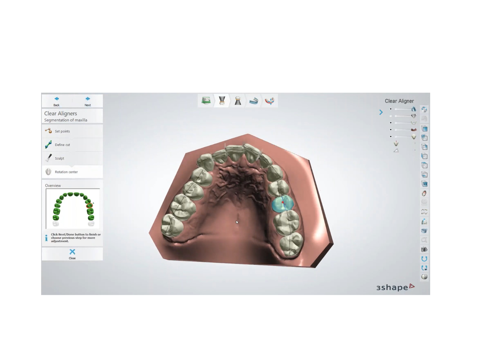 Setup 3D et planification numérique